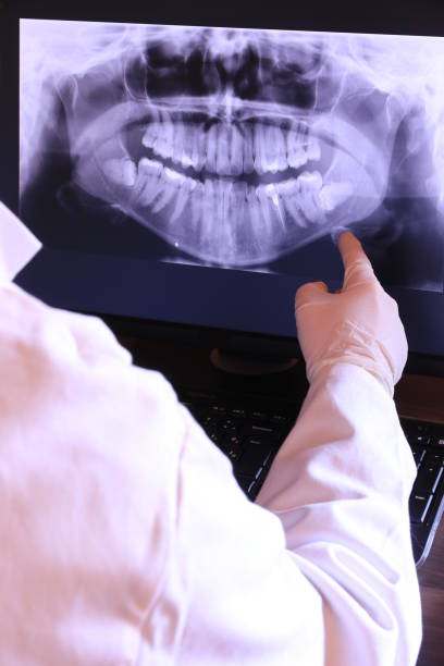 Best Knocked-Out Tooth (Avulsed Tooth) Treatment in New Castle, CO