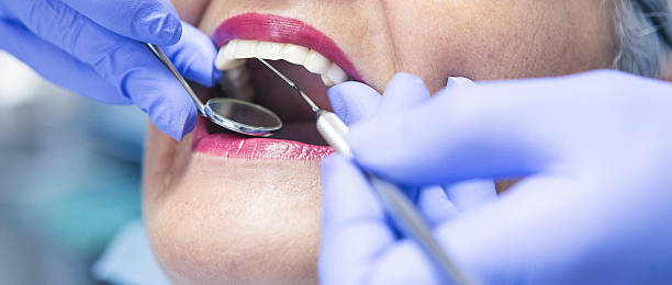 Best Emergency Dental Care for Sports Injuries in New Castle, CO